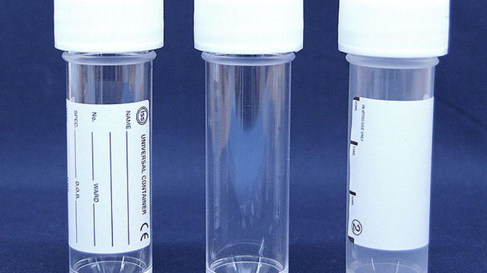 Processing a CSF sample
